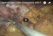 Laparoscopic Surgery in Mumbai